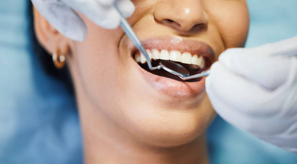 Best After-Hours Dental Trauma Care in South Park, WY