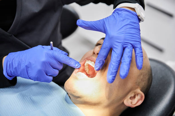 Best Emergency Tooth Extraction in South Park, WY