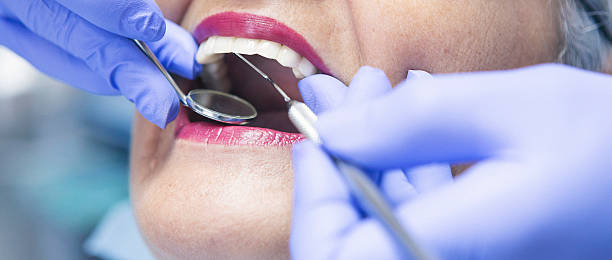 Best Emergency Tooth Extraction in South Park, WY